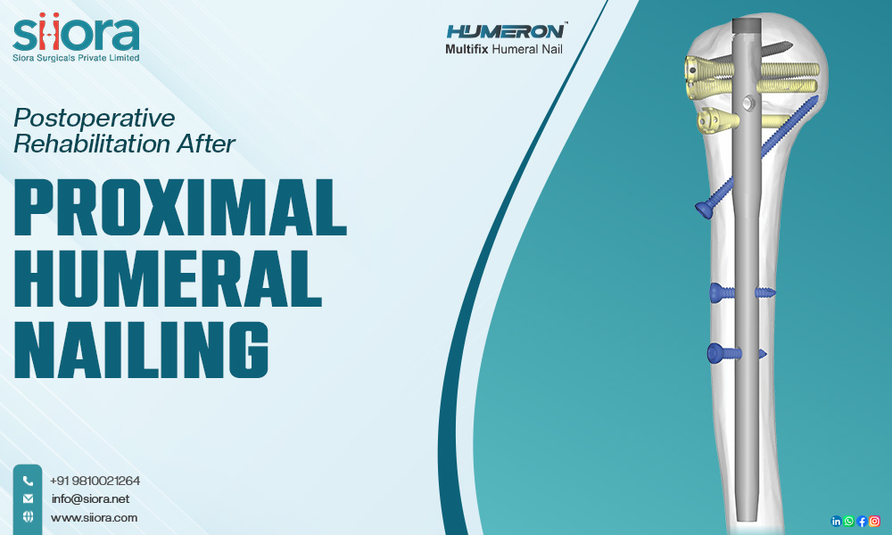 Postoperative Rehabilitation After Proximal Humeral Nailing